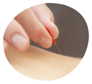 たすく鍼灸接骨院のお悩みリストの鍼灸治療のボタン